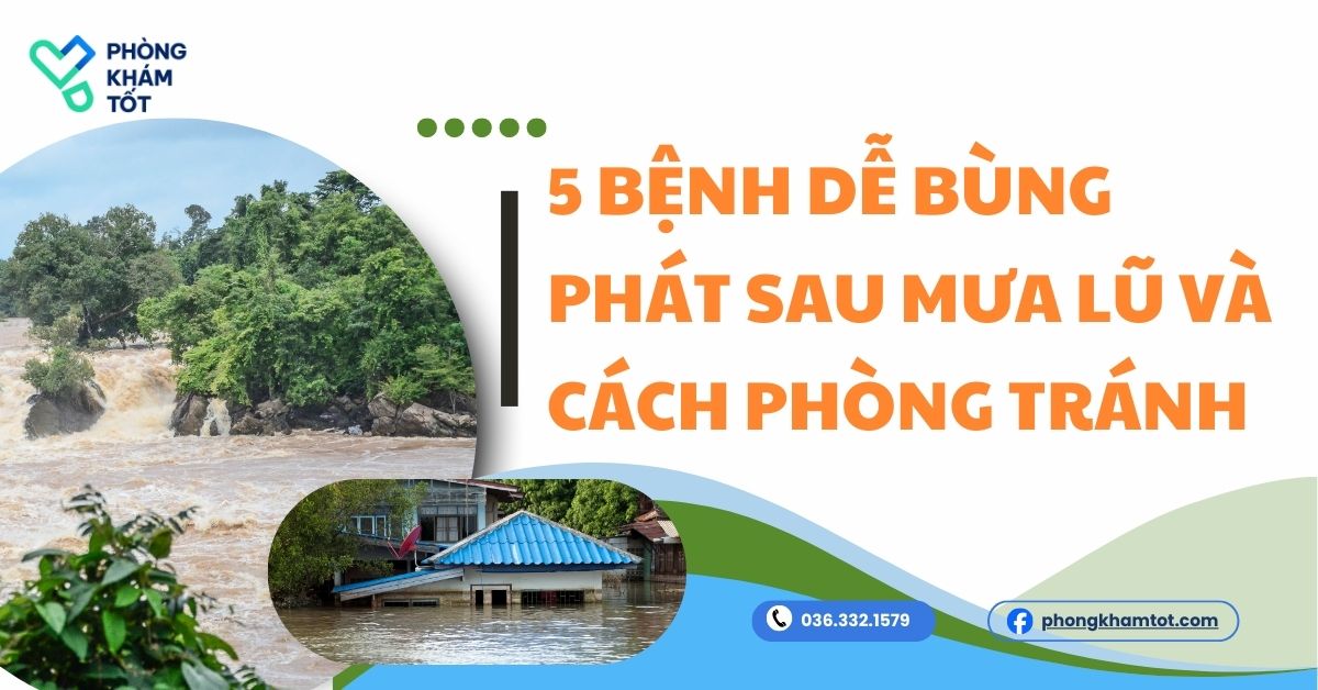 5 Bệnh dễ bùng phát sau mưa lũ và cách phòng tránh